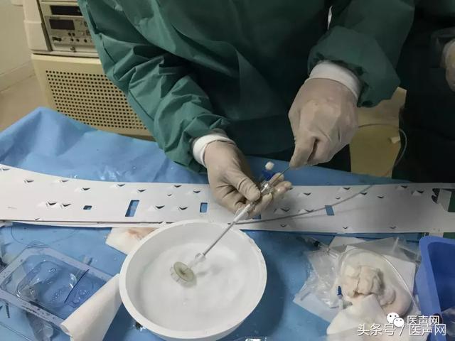 山东大学齐鲁医院首例LAmbre™左心耳封堵器成功植入
