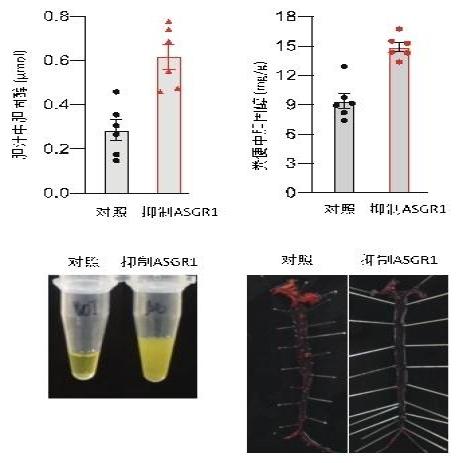 10-2抑制ASGR1促使胆固醇外排到胆汁和粪便中并可预防动脉粥样硬化斑块形成。　中国科协生命科学学会联合体 供图