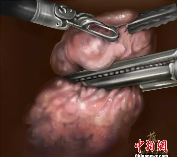 点击进入下一页